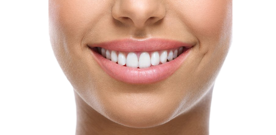 Teeth So White Leeds Mobile Teeth Whitening